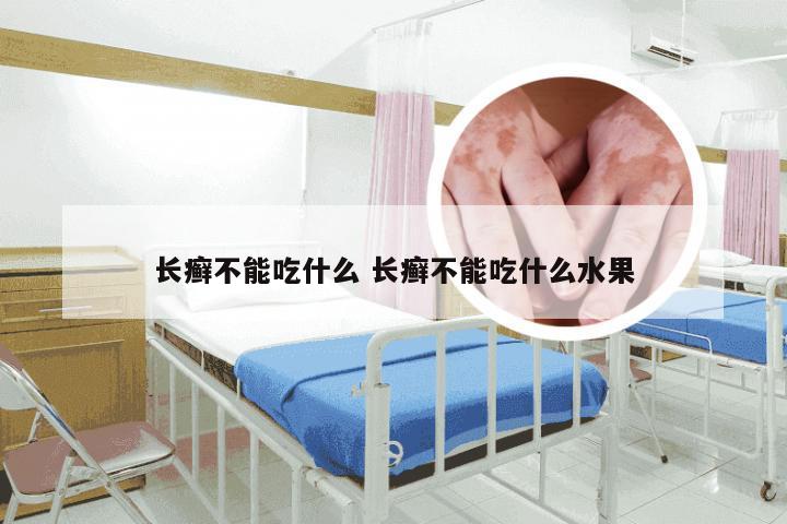 长癣不能吃什么 长癣不能吃什么水果