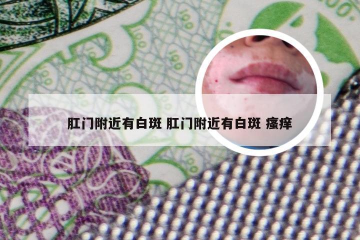 肛门附近有白斑 肛门附近有白斑 瘙痒