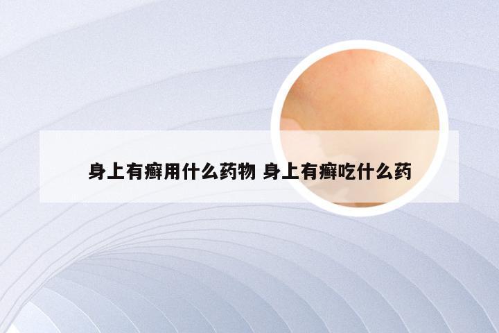 身上有癣用什么药物 身上有癣吃什么药