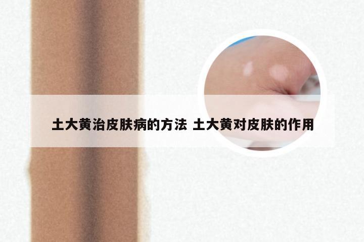 土大黄治皮肤病的方法 土大黄对皮肤的作用