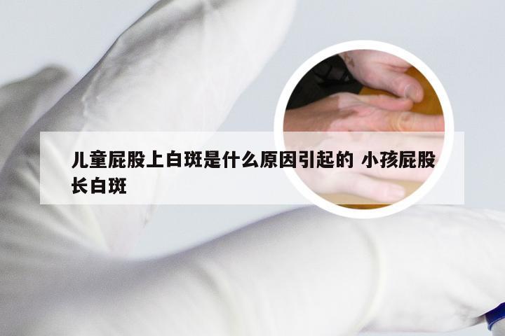 儿童屁股上白斑是什么原因引起的 小孩屁股长白斑
