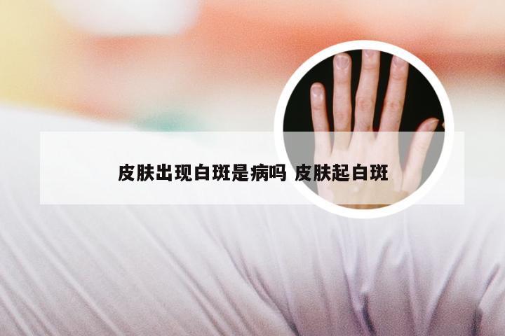 皮肤出现白斑是病吗 皮肤起白斑