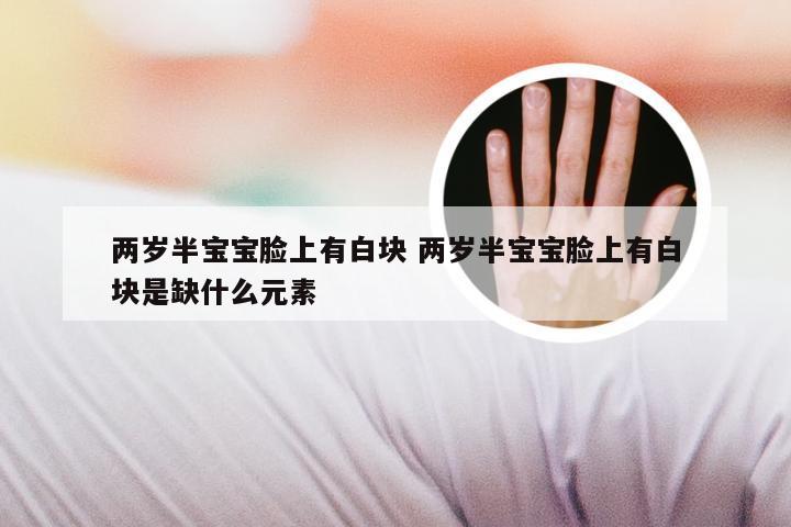 两岁半宝宝脸上有白块 两岁半宝宝脸上有白块是缺什么元素