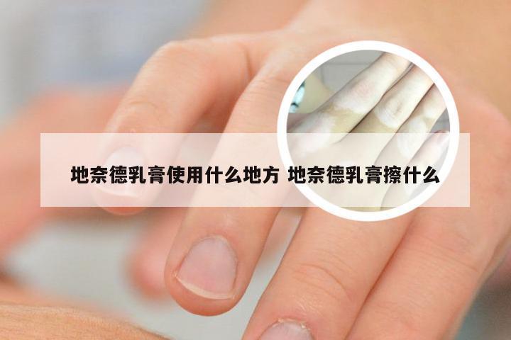 地奈德乳膏使用什么地方 地奈德乳膏擦什么