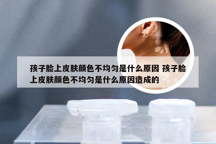孩子脸上皮肤颜色不均匀是什么原因 孩子脸上皮肤颜色不均匀是什么原因造成的