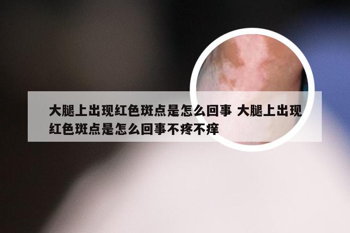 大腿上出现红色斑点是怎么回事 大腿上出现红色斑点是怎么回事不疼不痒