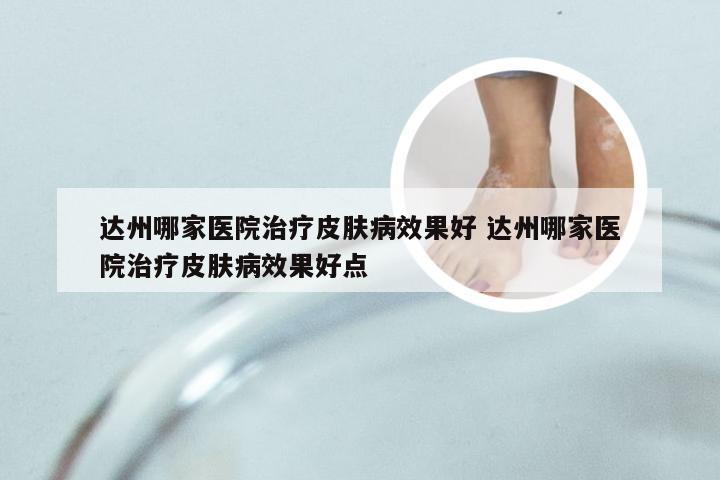 达州哪家医院治疗皮肤病效果好 达州哪家医院治疗皮肤病效果好点