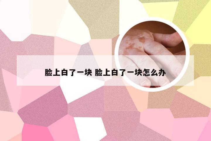 脸上白了一块 脸上白了一块怎么办