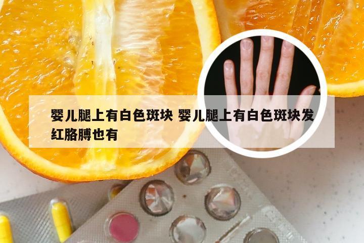 婴儿腿上有白色斑块 婴儿腿上有白色斑块发红胳膊也有
