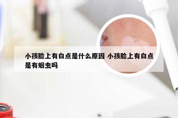 小孩脸上有白点是什么原因 小孩脸上有白点是有蛔虫吗