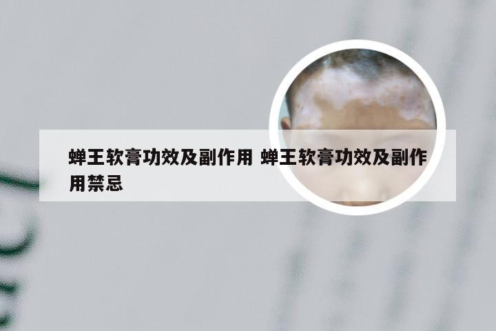 蝉王软膏功效及副作用 蝉王软膏功效及副作用禁忌