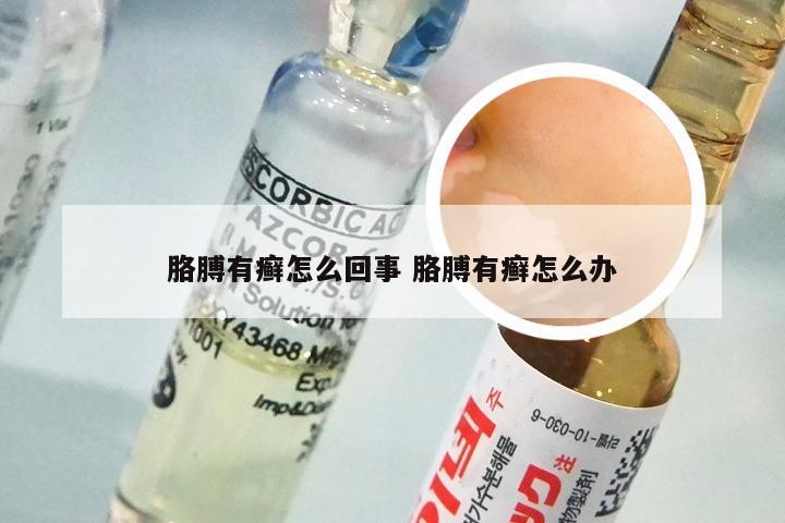 胳膊有癣怎么回事 胳膊有癣怎么办