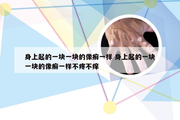 身上起的一块一块的像癣一样 身上起的一块一块的像癣一样不疼不痒