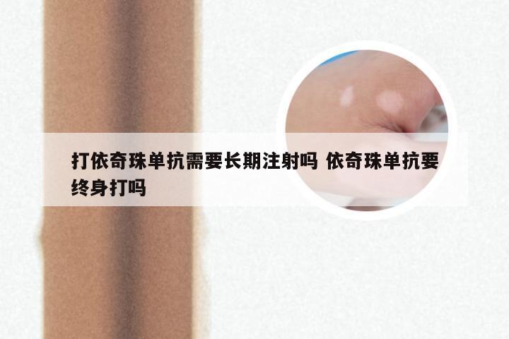 打依奇珠单抗需要长期注射吗 依奇珠单抗要终身打吗