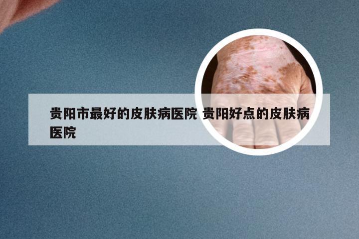 贵阳市最好的皮肤病医院 贵阳好点的皮肤病医院