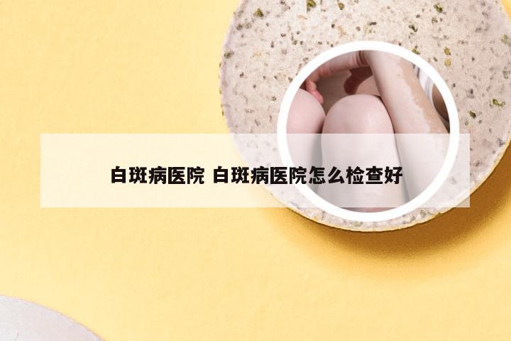 白斑病医院 白斑病医院怎么检查好