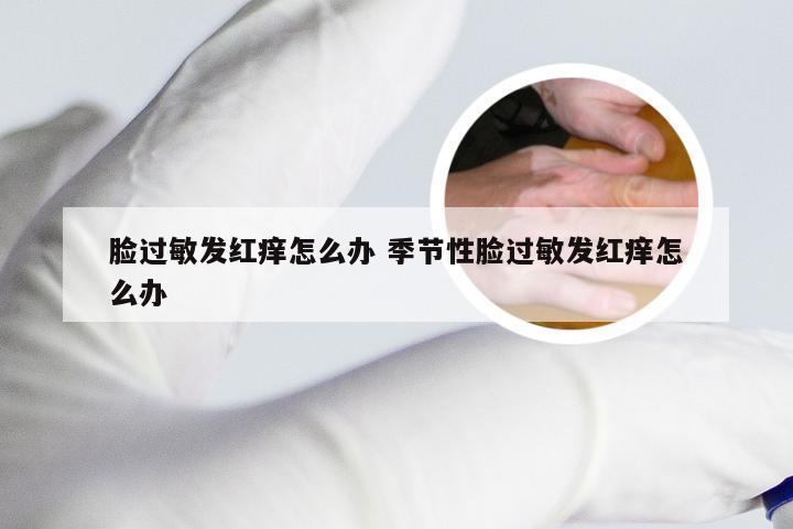 脸过敏发红痒怎么办 季节性脸过敏发红痒怎么办
