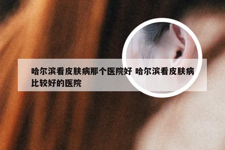 哈尔滨看皮肤病那个医院好 哈尔滨看皮肤病比较好的医院