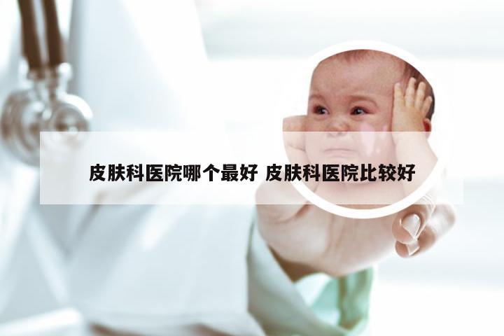 皮肤科医院哪个最好 皮肤科医院比较好