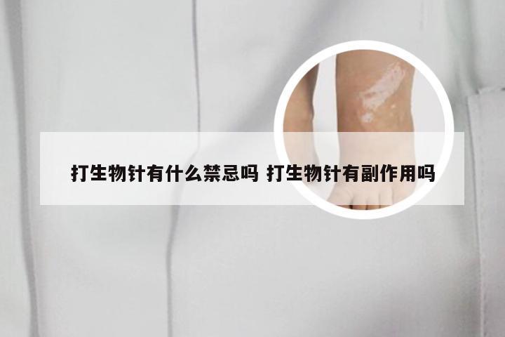 打生物针有什么禁忌吗 打生物针有副作用吗