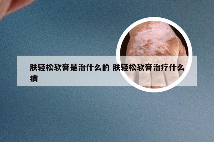 肤轻松软膏是治什么的 肤轻松软膏治疗什么病