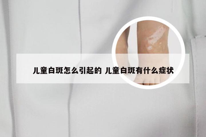 儿童白斑怎么引起的 儿童白斑有什么症状