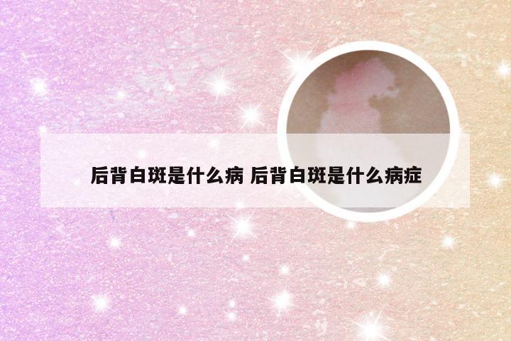 后背白斑是什么病 后背白斑是什么病症
