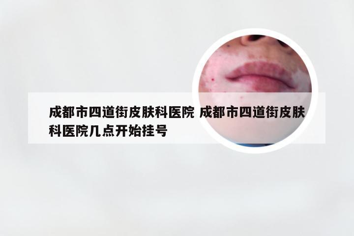 成都市四道街皮肤科医院 成都市四道街皮肤科医院几点开始挂号