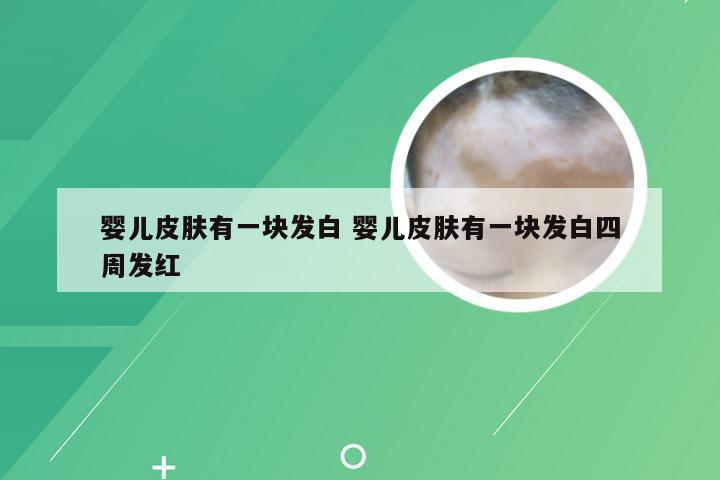 婴儿皮肤有一块发白 婴儿皮肤有一块发白四周发红