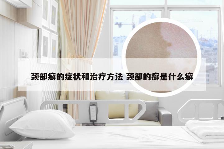 颈部癣的症状和治疗方法 颈部的癣是什么癣