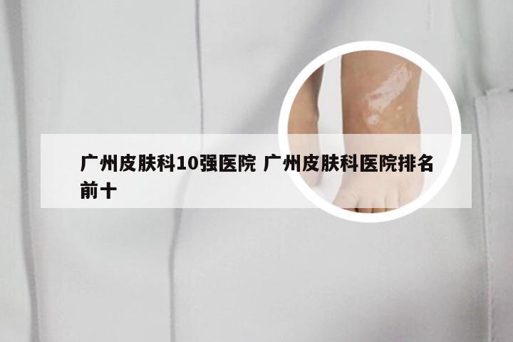 广州皮肤科10强医院 广州皮肤科医院排名前十