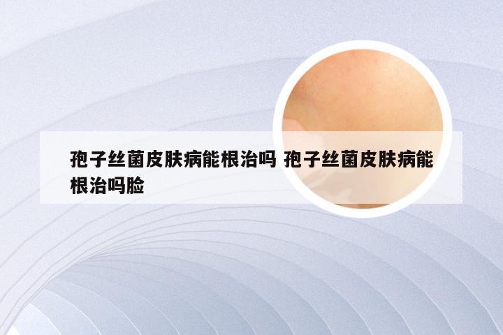 孢子丝菌皮肤病能根治吗 孢子丝菌皮肤病能根治吗脸