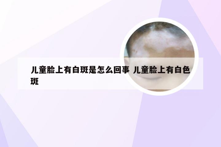 儿童脸上有白斑是怎么回事 儿童脸上有白色斑
