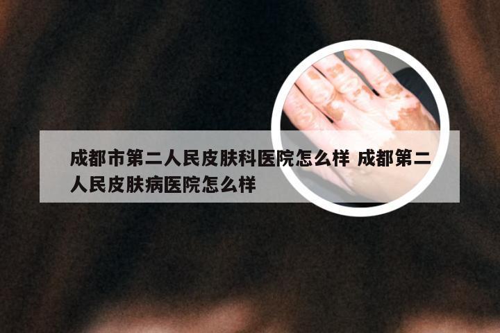 成都市第二人民皮肤科医院怎么样 成都第二人民皮肤病医院怎么样