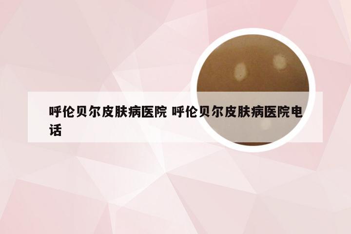 呼伦贝尔皮肤病医院 呼伦贝尔皮肤病医院电话