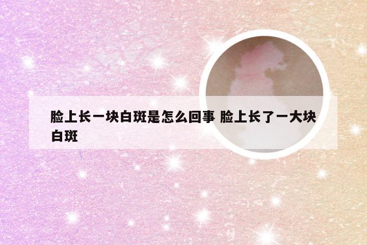 脸上长一块白斑是怎么回事 脸上长了一大块白斑