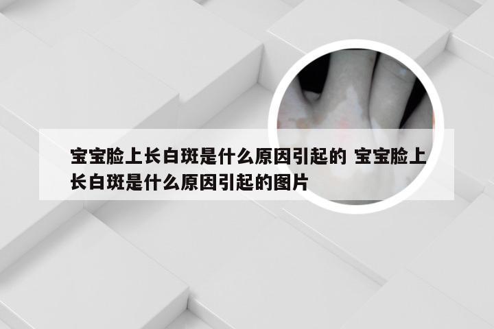 宝宝脸上长白斑是什么原因引起的 宝宝脸上长白斑是什么原因引起的图片