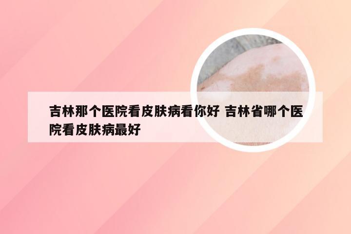 吉林那个医院看皮肤病看你好 吉林省哪个医院看皮肤病最好
