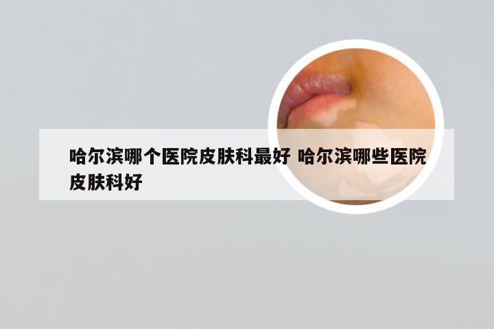 哈尔滨哪个医院皮肤科最好 哈尔滨哪些医院皮肤科好