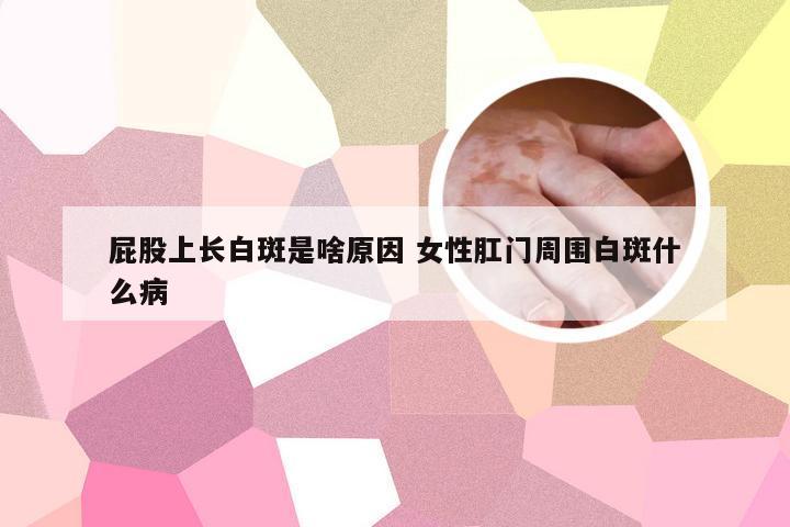 屁股上长白斑是啥原因 女性肛门周围白斑什么病
