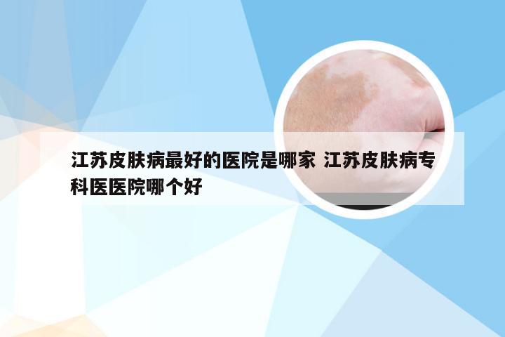 江苏皮肤病最好的医院是哪家 江苏皮肤病专科医医院哪个好