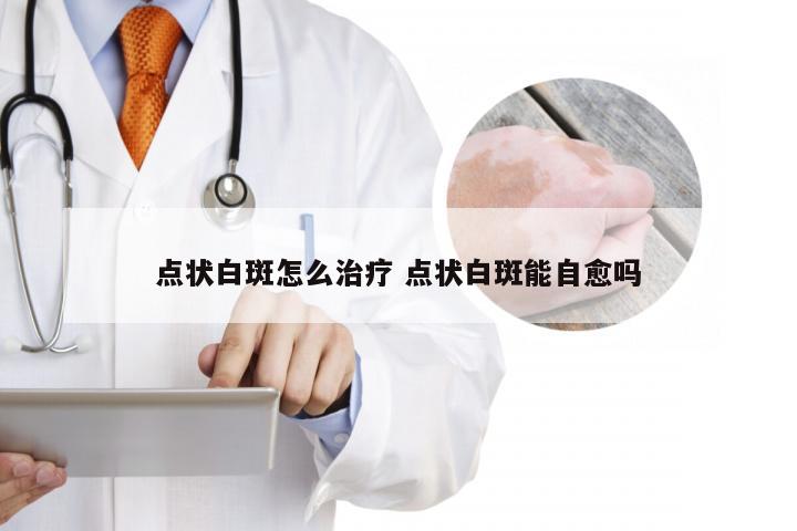 点状白斑怎么治疗 点状白斑能自愈吗
