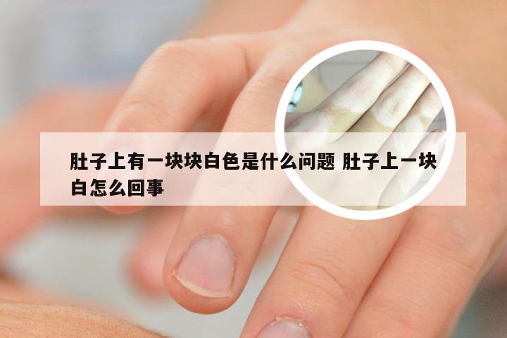 肚子上有一块块白色是什么问题 肚子上一块白怎么回事