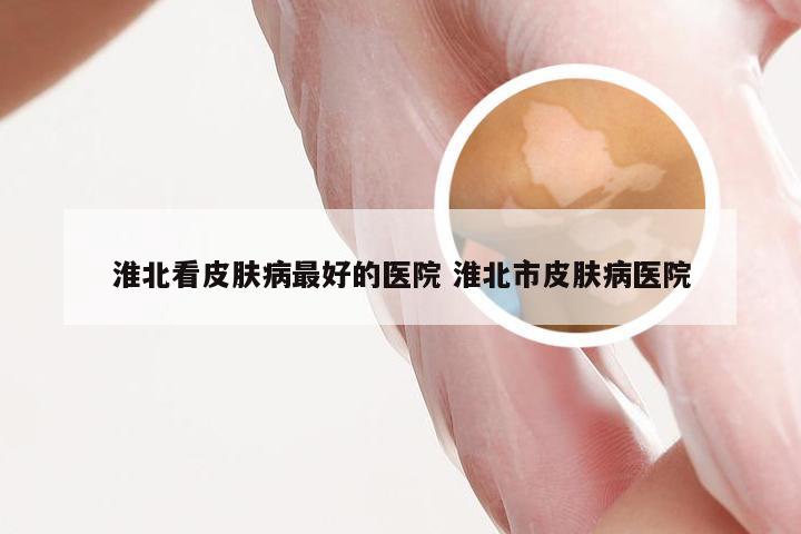 淮北看皮肤病最好的医院 淮北市皮肤病医院