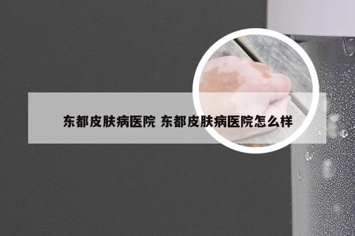 东都皮肤病医院 东都皮肤病医院怎么样