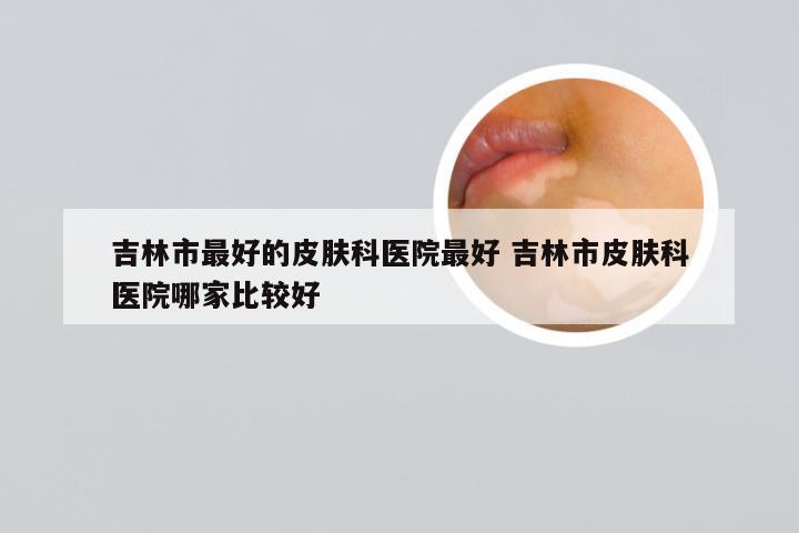 吉林市最好的皮肤科医院最好 吉林市皮肤科医院哪家比较好