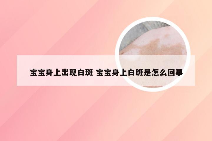 宝宝身上出现白斑 宝宝身上白斑是怎么回事