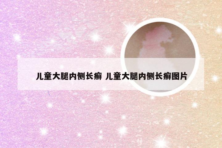 儿童大腿内侧长癣 儿童大腿内侧长癣图片