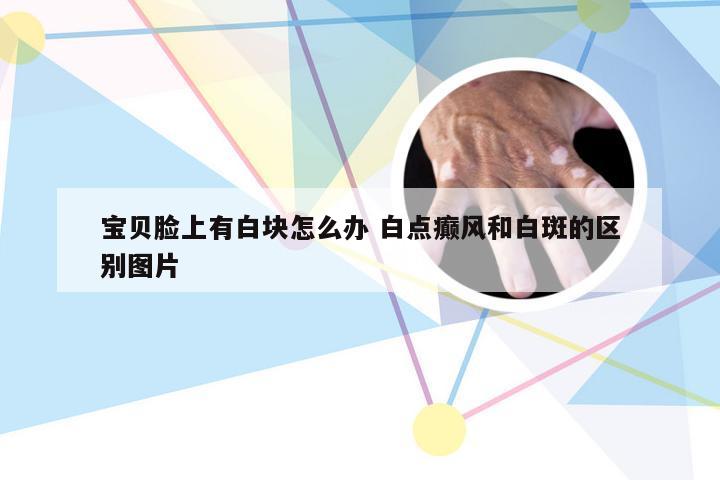 宝贝脸上有白块怎么办 白点癫风和白斑的区别图片