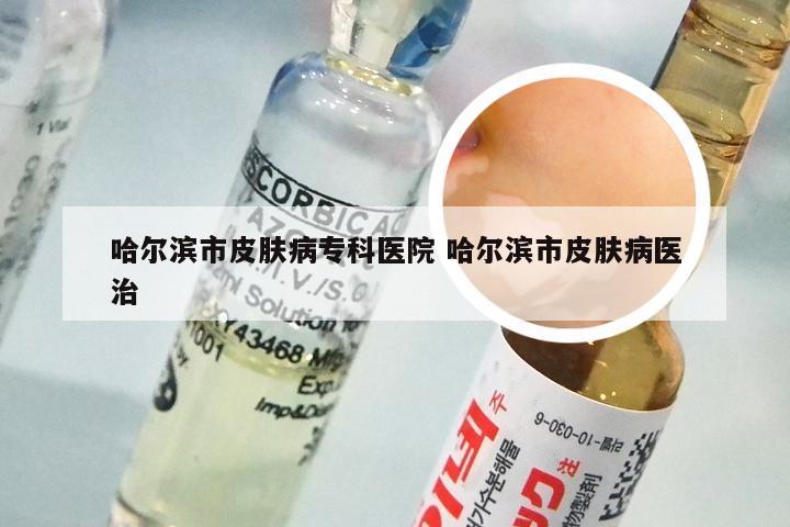 哈尔滨市皮肤病专科医院 哈尔滨市皮肤病医治